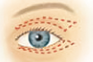 Lid Operationen – Augenärztliche Gemeinschaftspraxis | Dr. Heuring, Dr. Jung & Kollegen