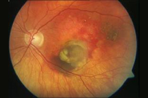 Augenhintergrund – Augenärztliche Gemeinschaftspraxis | Dr. Heuring, Dr. Jung & Kollegen